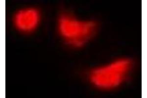 Immunofluorescent analysis of IMPDH2 staining in Hela cells. (IMPDH2 antibody)