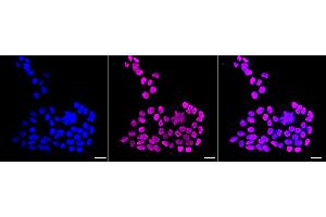 Immunocytochemical staining of HAP-1 cells with Histone H1. (Recombinant HIST1H1C antibody)