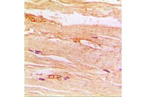 Immunohistochemical analysis of GLUT4 staining in human muscle formalin fixed paraffin embedded tissue section. (GLUT4 antibody  (Center))