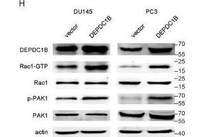 DEPDC1B regulates the Rho signaling pathway and binds to Rac1. (PAK1 antibody  (AA 1-240))