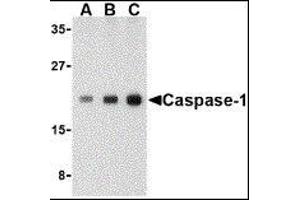 Western Blotting (WB) image for anti-Caspase 1 (CASP1) (C-Term) antibody (ABIN2477902) (Caspase 1 antibody  (C-Term))
