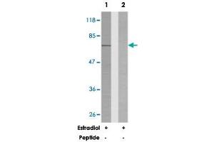 Western blot analysis of extracts from SK-OV-3 cells treated with estradiol (0. (Paxillin antibody)
