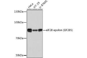 Western blot analysis of extracts of various cell lines, using eIF2B epsilon (EIF2B5) (EIF2B5) Rabbit mAb (ABIN7267038) at 1:1000 dilution.