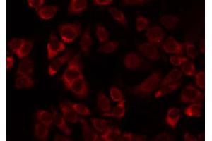 ABIN6274727 staining Hela by IF/ICC. (MRPL11 antibody  (Internal Region))