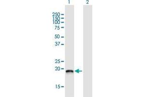 Western Blot analysis of DCTPP1 expression in transfected 293T cell line by DCTPP1 MaxPab polyclonal antibody. (DCTPP1 antibody  (AA 1-170))