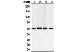 Western blot analysis of PLC gamma 2 expression in A549 (A), NIH3T3 (B), mouse brain (C), rat brain (D) whole cell lysates. (Phospholipase C gamma 2 antibody  (Center))