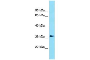 Western Blotting (WB) image for anti-Glycerophosphodiester Phosphodiesterase Domain Containing 1 (GDPD1) (N-Term) antibody (ABIN2791029) (GDPD1 antibody  (N-Term))