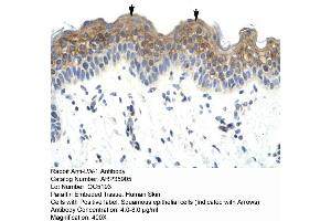 Human Skin (HSFX1 antibody  (Middle Region))