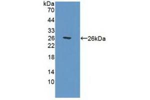 Detection of Recombinant POLg1, Human using Polyclonal Antibody to Polymerase DNA Directed Gamma 1 (POLg1)
