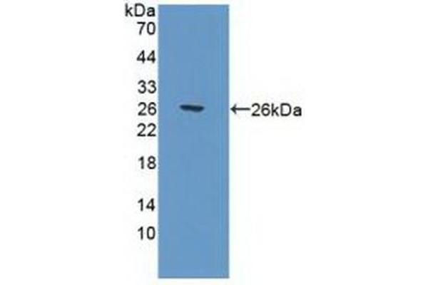 POLG anticorps  (AA 1041-1239)
