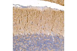 Immunohistochemistry of paraffin-embedded mouse brain using Kallikrein 8 Rabbit mAb (ABIN7268065) at dilution of 1:100 (40x lens). (Kallikrein 8 antibody)