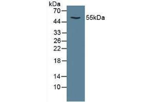 Figure. (CAMK2A antibody  (AA 1-478))