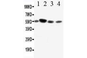 Anti-CD89 antibody, Western blotting Lane 1: A549 Cell Lysate Lane 2: U87 Cell Lysate Lane 3: RAJI Cell Lysate Lane 4: JURKAT Cell Lysate (FCAR antibody  (AA 84-101))