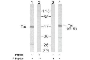 Image no. 2 for anti-Microtubule-Associated Protein tau (MAPT) (pThr181) antibody (ABIN196801) (MAPT antibody  (pThr181))