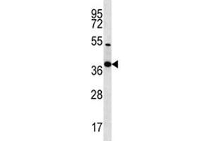 NKX2. (Nkx2-2 antibody  (AA 2-2))