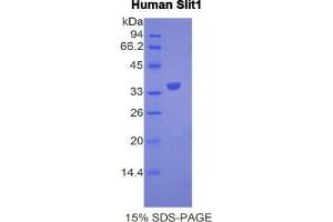 SDS-PAGE analysis of Human Slit Homolog 1 Protein. (SLIT1 Protein)