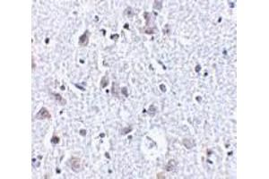 Immunohistochemistry of BRSK1 in human brain tissue with BRSK1 antibody at 2. (BRSK1 antibody  (C-Term))