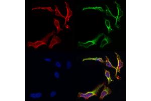 ABIN6259853 and ABIN6266930 staining Hela by IF/ICC. (AKAP2 antibody  (N-Term))