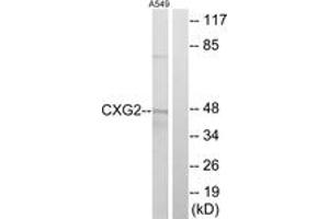Western blot analysis of extracts from A549 cells, using CXG2 Antibody.