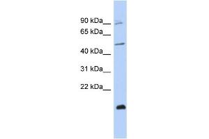 WB Suggested Anti-ZNF645 Antibody Titration:  0. (ZNF645 antibody  (Middle Region))