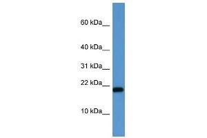 SH2D1A antibody (70R-10049) used at 0. (SH2D1A antibody  (C-Term))