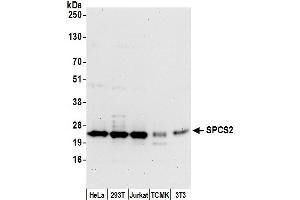 anti-Signal Peptidase Complex Subunit 2 Homolog (SPCS2) (AA 176-226) antibody