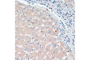 Immunohistochemistry of paraffin-embedded human liver using DBH antibody (ABIN6130337, ABIN6139418, ABIN6139419 and ABIN6218164) at dilution of 1:200 (40x lens).