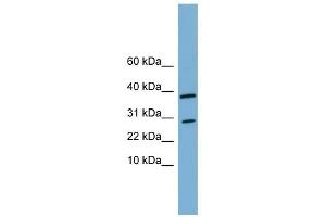 VNN3 antibody used at 1 ug/ml to detect target protein. (VNN3 antibody  (N-Term))