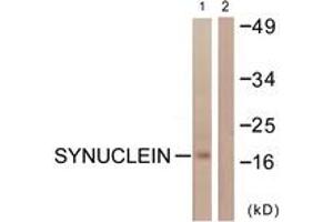 Western blot analysis of extracts from HuvEc cells, using Synuclein (Ab-129) Antibody. (Synuclein antibody  (AA 91-140))