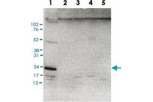 Western Blot (Cell lysate) analysis of (1) 25 ug whole cell extracts of HeLa cells, (2) 1 ug of recombinant histone H2A, (3) 1 ug of recombinant histone H2B, (4) 1 ug of recombinant histone H3, and (5) 1 ug of recombinant histone H4. (HIST1H3A antibody  (ubLys119))