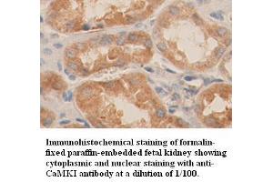 Image no. 1 for anti-Calcium/calmodulin-Dependent Protein Kinase I (CAMK1) (C-Term) antibody (ABIN791097) (CAMK1 antibody  (C-Term))