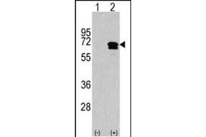 Western blot analysis of CKK2 (arrow) using rabbit polyclonal CKK2 Antibody (C-term) (ABIN1882069 and ABIN2841278). (CAMKK2 antibody  (C-Term))
