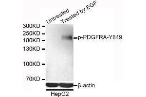 Western blot analysis of extracts of HepG2 cells, using Phospho-PDGFRA-Y849 antibody. (PDGFRA antibody  (pTyr849))
