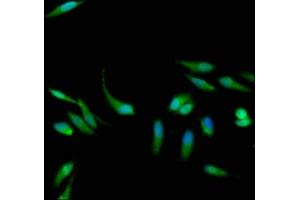 Immunofluorescence staining of Hela cells with ABIN7154629 at 1:133, counter-stained with DAPI. (K-RAS antibody  (AA 2-168))