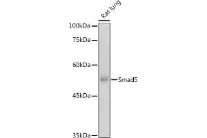 Western blot analysis of extracts of Rat lung, using Smad5 antibody (ABIN1682808, ABIN5663732, ABIN5663734 and ABIN6213914) at 1:500 dilution. (SMAD5 antibody  (AA 140-240))