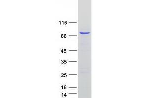 Validation with Western Blot