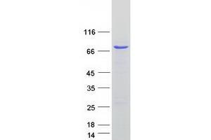Validation with Western Blot (CDK5RAP3 Protein (Myc-DYKDDDDK Tag))