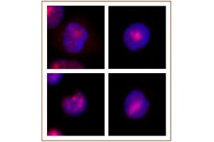 WRN antibody (mAb) tested by Immunofluorescence. (RECQL2 antibody)