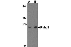 Image no. 1 for anti-Mex-3 Homolog D (MEX3D) (Internal Region) antibody (ABIN341677) (MEX3D antibody  (Internal Region))