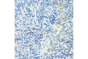 Immunohistochemistry of paraffin-embedded mouse spleen using TIM-3/H antibody (ABIN3016172, ABIN3016173, ABIN3016174, ABIN1680159 and ABIN6219599) at dilution of 1:100 (40x lens). (TIM3 antibody  (AA 22-202))