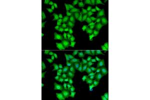 Immunofluorescence analysis of HeLa cells using CPSF3L antibody (ABIN5973943).