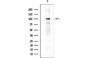 Western blot analysis of lysates from Mouse kidney, using FOXM1 Mouse Monoclonal Antibody at 1/1000 dilution.