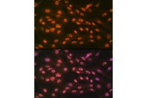 Immunofluorescence (IF) image for anti-Lysine (K)-Specific Demethylase 4B (KDM4B) antibody (ABIN7268329)