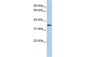 WB Suggested Anti-HADH Antibody Titration: 0. (HADH antibody  (C-Term))