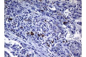 Image no. 1 for anti-Polymerase (DNA Directed) iota (POLI) (AA 458-740) antibody (ABIN1491524) (POLI antibody  (AA 458-740))