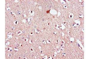 Immunohistochemistry of paraffin-embedded human brain tissue using ABIN7158744 at dilution of 1:100