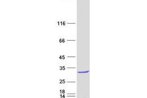 Validation with Western Blot (RAB28 Protein (Transcript Variant 1) (Myc-DYKDDDDK Tag))