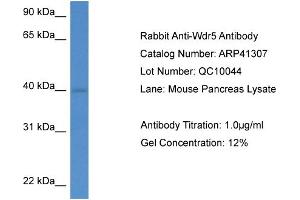 Western Blotting (WB) image for anti-WD Repeat Domain 5 (WDR5) (C-Term) antibody (ABIN2776739) (WDR5 antibody  (C-Term))