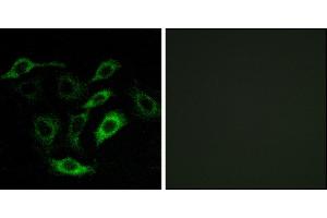 Immunofluorescence analysis of A549 cells, using PTGDR antibody.