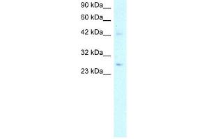 WB Suggested Anti-ACDC Antibody Titration:  5. (ADIPOQ antibody  (N-Term))